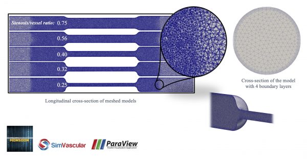 Illustration of computational fluid dynamics.