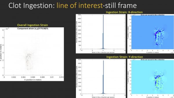 Clot ingestion line of interest still frame image. 