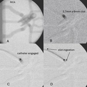 Microscope image of synthetic blood clot.