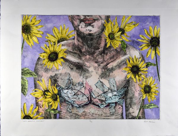 A watercolor intaglio of a person who just underwent breast surgery titled "Post-Operative Euphoric."