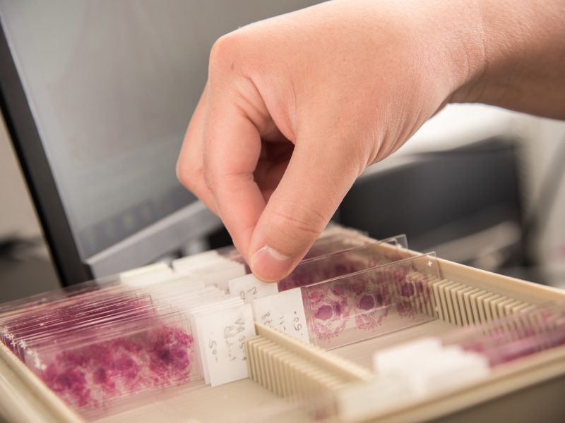 Slides in a lab tray.