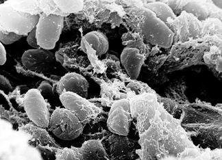 Plague