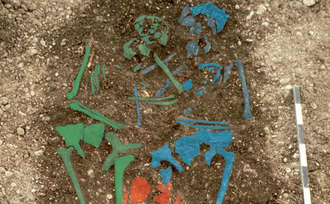 skeletal remains