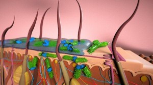 Skin infections in micro image