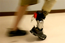 Bionic Ankle