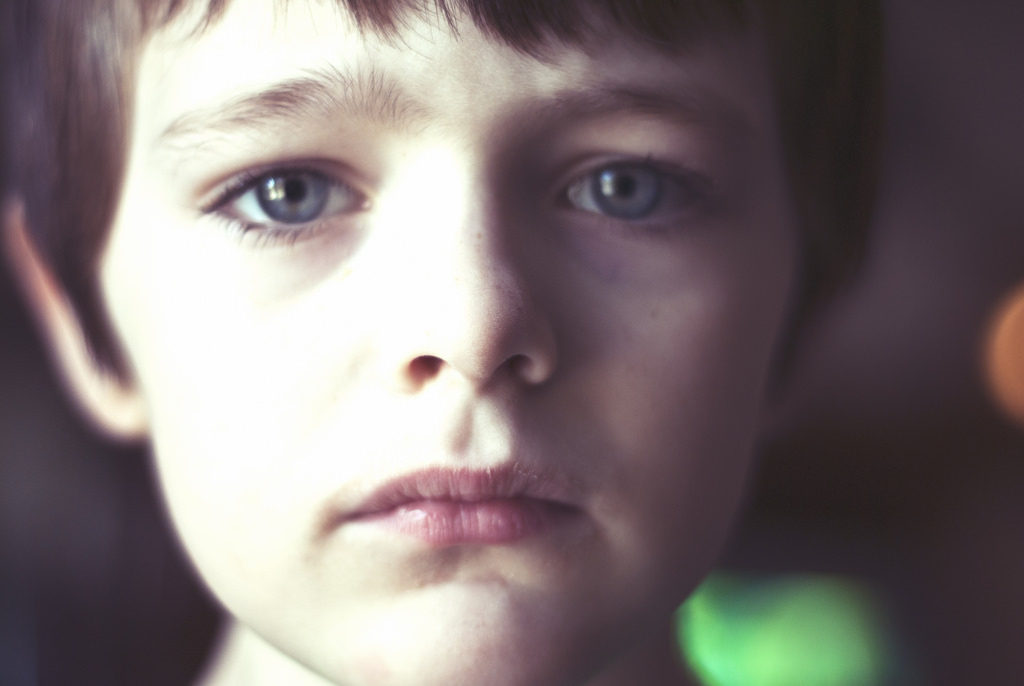 Patient with autism spectrum disorder